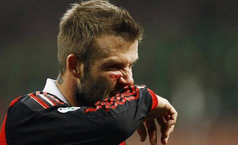 Beckham rách gò má trong những phút đầu trận đấu với Chievo... Ảnh: Reuters