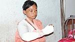 Thêm một bé gái bị đánh dã man như Hào Anh