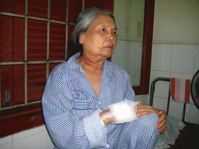 Bà Dương đang điều trị vết thương tại bệnh viện