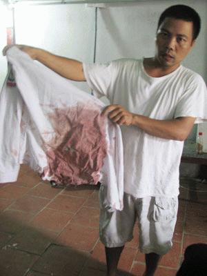 Chiếc áo đồng phục cháu Trang mặc hôm xảy ra vụ việc,  máu còn nhuộm đỏ  và bị rách do dao chém.